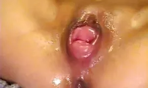 لەناو دەبرێت بەهۆی گ ...