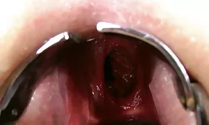 دوو مشتکردن لە کۆم،  ...